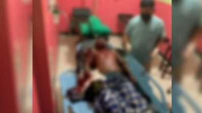 Tangan Warga Tamilouw Putus Diduga Terkena Bom Rakitan