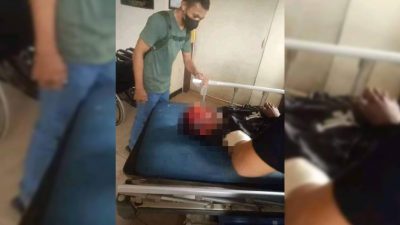 Mahasiswa STIKES Korban Tabrak Lari Meninggal Dunia, Keluarga Minta Polisi Tangkap Penabrak