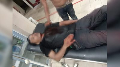 Lolos dari Pengeroyokan, Mahasiswa UIN Ambon Dibacok OTK Bersimbah Darah