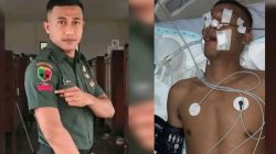 Dua Pekan Kritis, Pratu Andi Bugis Hayoto Wafat, Hasil Visum Ungkap Penganiayaan di Kepala